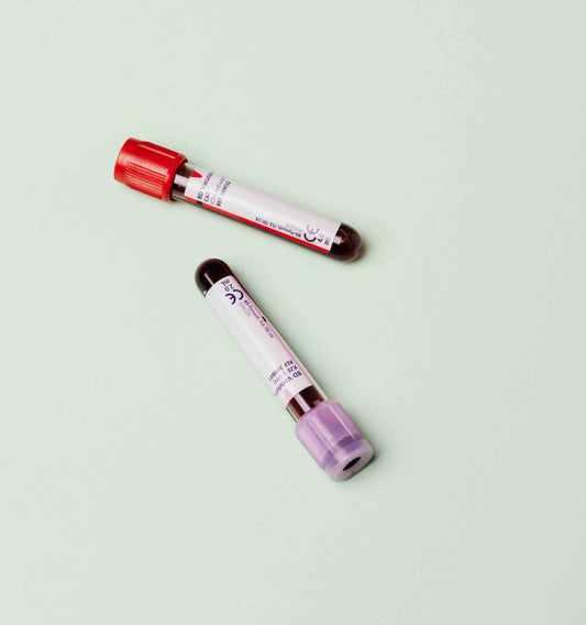 DONOR - TEST testosteronu